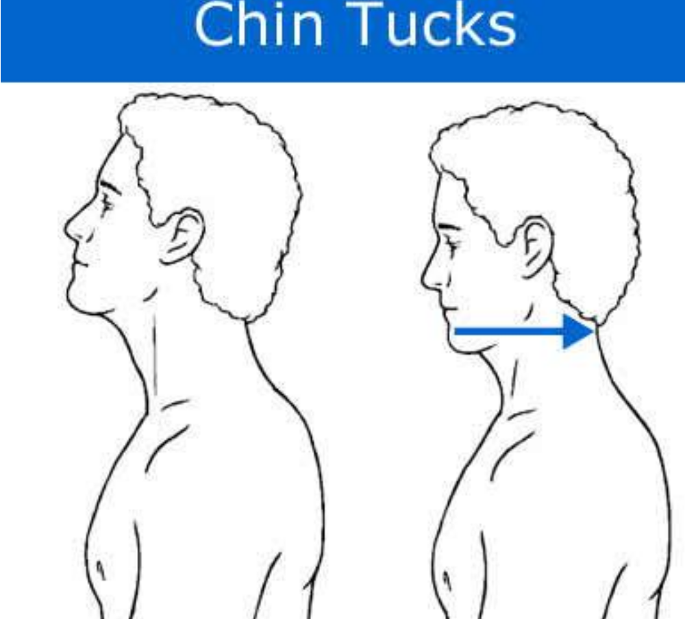 chin tuck